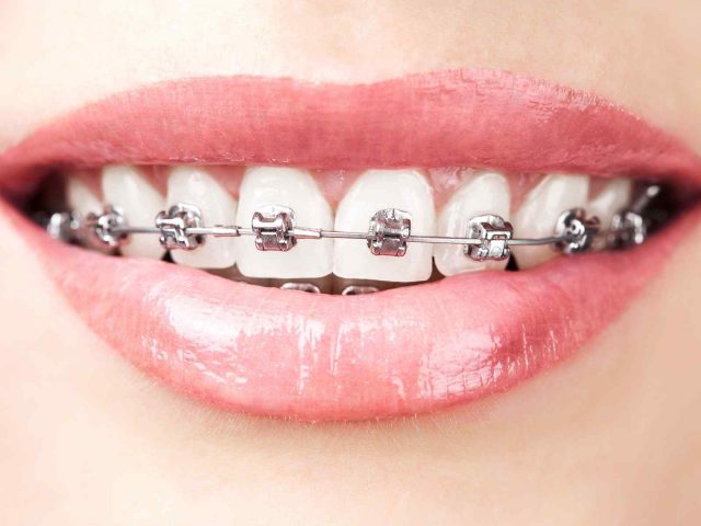 https://jaimeramosmedicodentista.pt/inicio/wp-content/uploads/2020/01/post_05-640x480.jpg